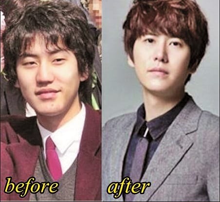 cho-kyuhyun
